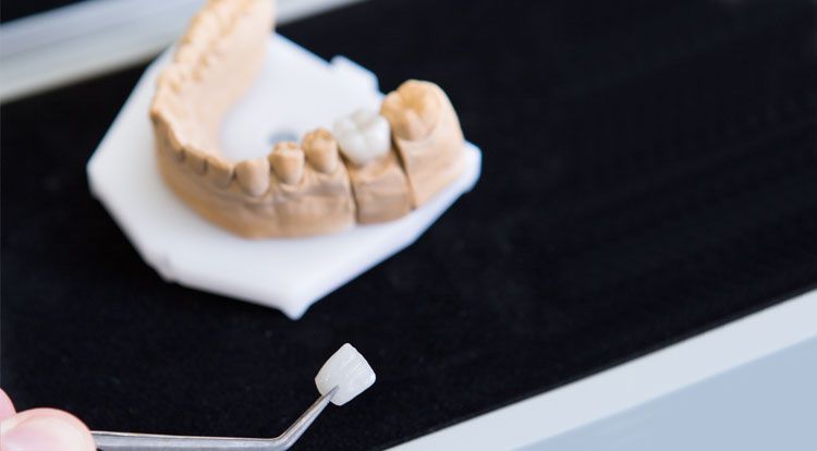 Praxiseigene Dentalmanufaktur