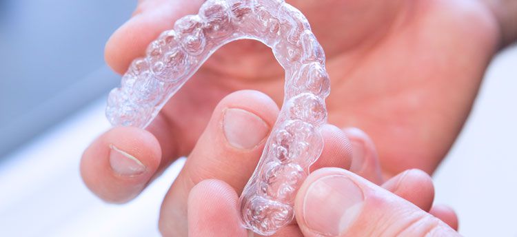 Invisalign in Düsseldorf, transparente Zahnschienen